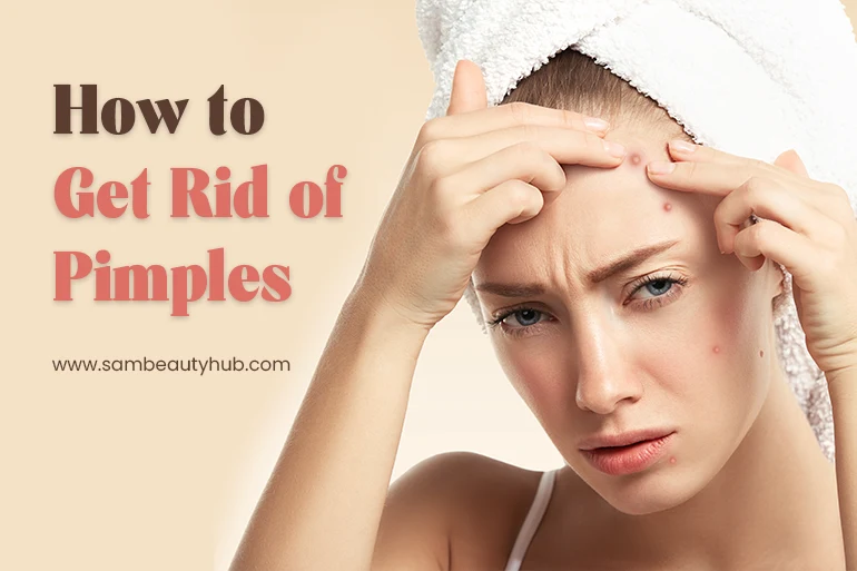 How to Get Rid of Pimples