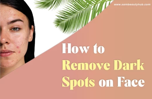 How to Remove Dark Spots on the Face