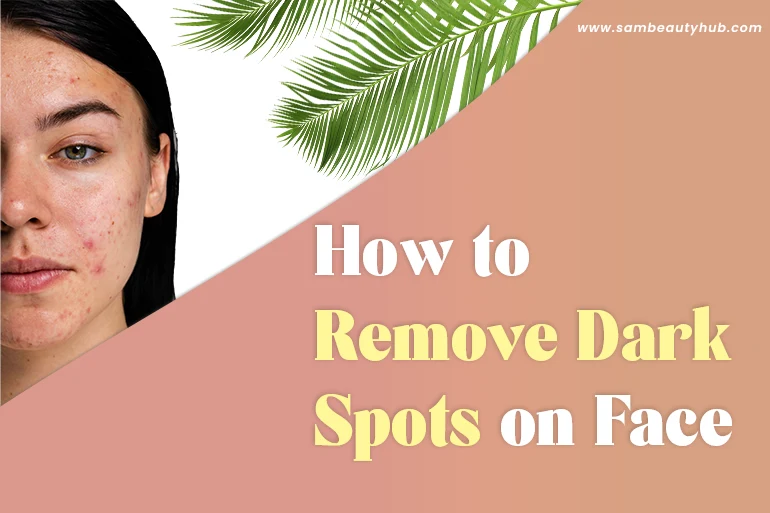 How to Remove Dark Spots on the Face